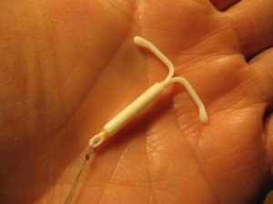 Mirena IUD