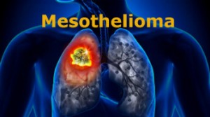 Asbestos and Mesothelioma