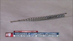 Essure coil