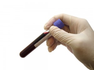 xarelto antidote xarelto antidote
