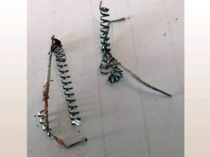 Used coils after Essure removal 