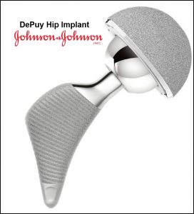 Hip implant lawsuit