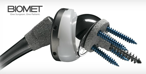 biomet shoulder replacement lawsuit