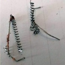 Essure coils broken