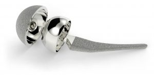 metal-on-metal hip implant