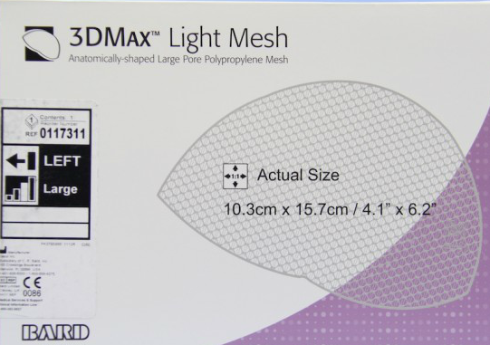 Bard 3DMAX hernia mesh lawsuit