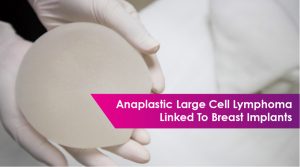 Textured breast implant cancer lawsuit