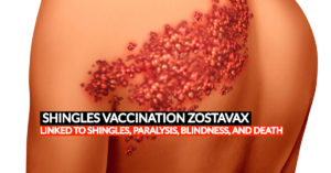 Zostavax shingles vaccine lawsuit