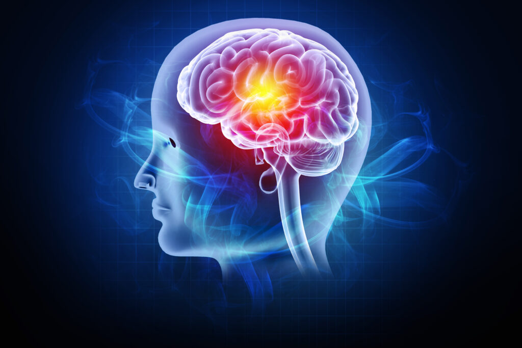 Traumatic Brain Injury